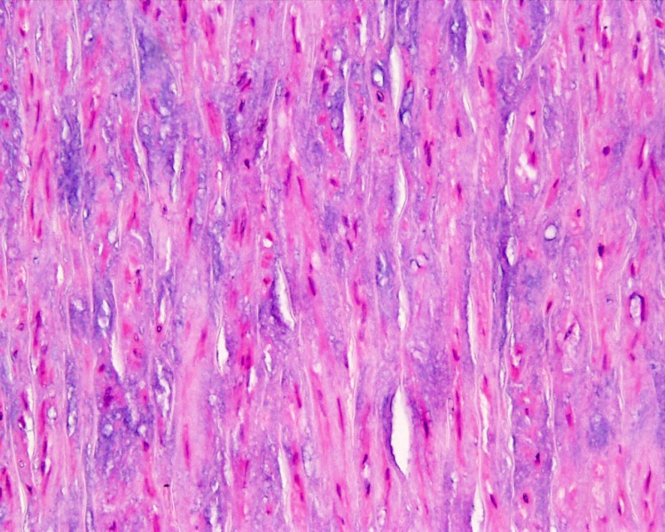 File:Artery histology 15.jpg