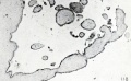 Fig. 118. An early, non- vascular, hydatid villus from the same specimen, showing constrictions. X50.