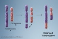 Chromosome - balanced translocation