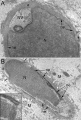 Human spermatid electron micrograph[33]