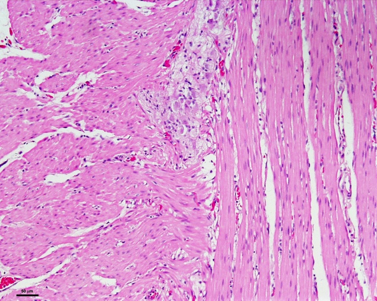 File:Smooth muscle histology 005.jpg