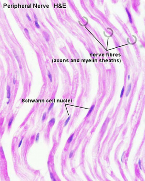 Peripheral nerve histology 02.jpg