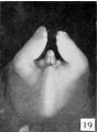 Fig. 19. Carnegie Embryo No. 2393