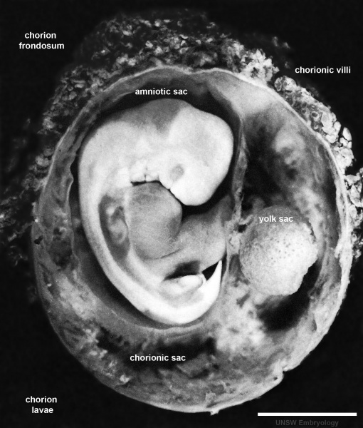 File:Stage17 embryo and membranes02.jpg