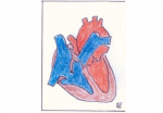 Heart Defect E.PNG