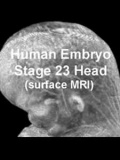 Stage23 MRI 3D04 icon.jpg