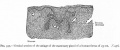 Fig. 357. Vertical section of the anlage of the mammary gland of a human foetus of 25 cm.