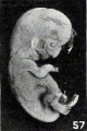 Figs. 52-63. Illustrating the absence of fundamental differences between the group of fetus compressus and grade 3 of the normal specimens. No. 1779 (fig. 57) normal. XI.