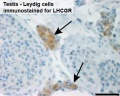 Human Leydig cells (Interstitial cells)