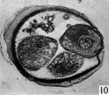 Figs. 9, 10. Two consecutive sections through the four-cell ovum shown in fig. 8. x 520.