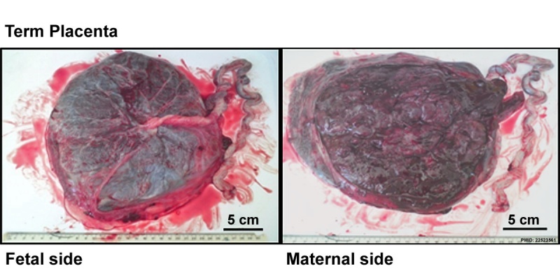 File:Placenta term anatomy 01.jpg