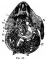 Fig 23 human embryo 11 mm