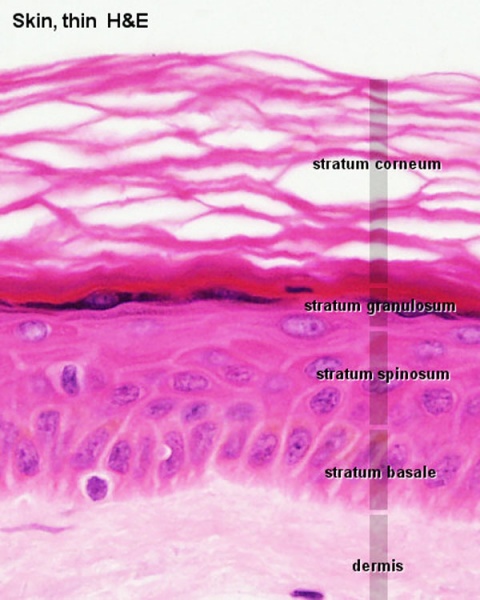 File:Adult epidermis histology 01.jpg
