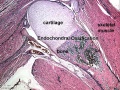 Fetal knee region