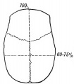 Fig. 138. Diagram of a Long-head (Dolichocephalic).