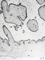 Fig. 117. A portion of the chorionic membrane from No. 714, showing decidedly sinuous epithelium. X50.