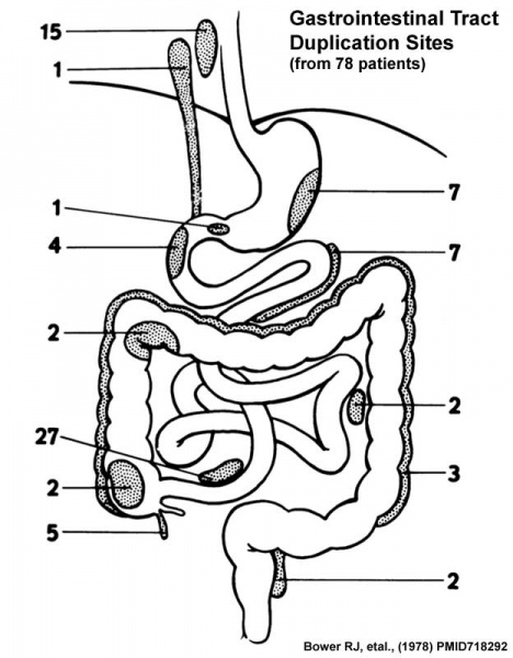 File:Gastrointestinal tract duplication sites.jpg