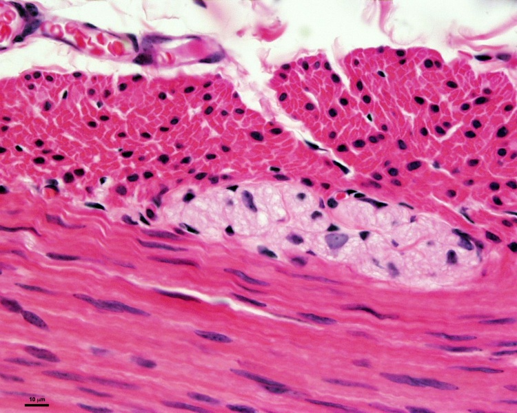 File:Smooth muscle histology 004.jpg