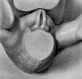 Fig. 5. Carnegie Embryo 1936, 14 mm, male. X 14.5.