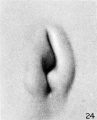 Fig. 24. Embryo No. 955, 17 mm. long. X 24.