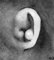 Fig. 40. Embryo No. 1561, 57 mm.
