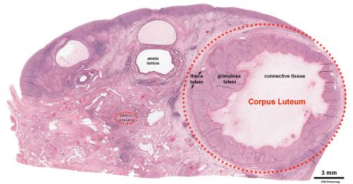 Corpus Luteum in ovary