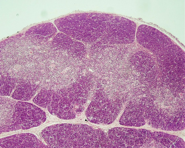 Thymus histology 01.jpg
