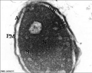 Human spermatozoa nucleus EM03.jpg