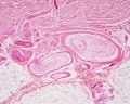 Pacinian corpuscle histology 02.jpg