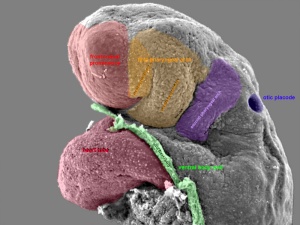 Human Embryo (Stage 11) SEM Pharyngeal arches