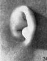 Fig. 31. Embryo No. 1840a, 38.5 mm. (R.)