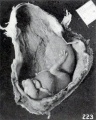 Fig. 223. External appearance of fetus in situ. No. 1751. X0.57.