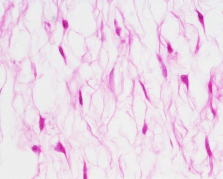 File:Placenta histology 003.jpg