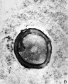 FIG. 6. Ovarian egg from a doe mated 8 hours previously. The first polar body has been given off.