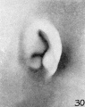 Fig. 30. Embryo No. 1980, 37 mm.
