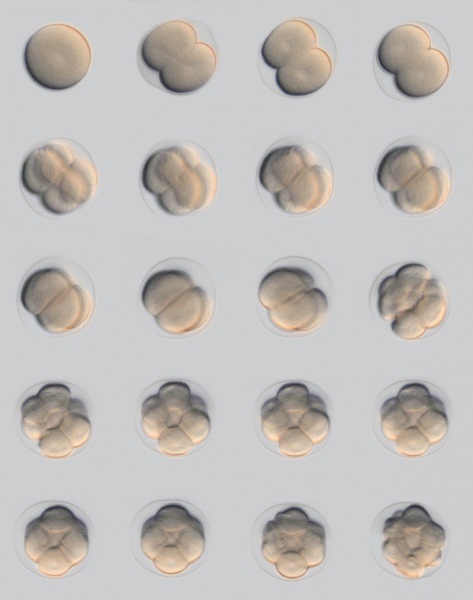 File:Sea Urchin- early embryo cleavage pattern.jpg