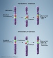 Chromosome - inversion