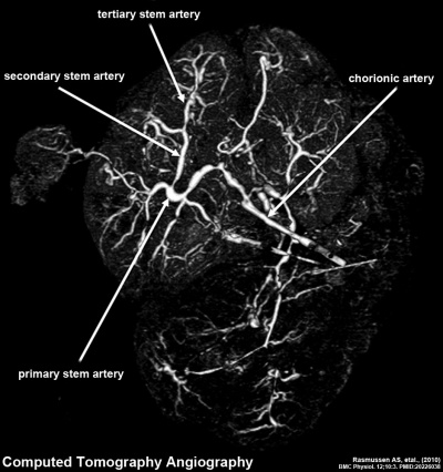 Human placenta vascular CT 01.jpg