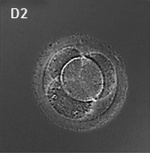 Human Embryo (day 2) 4 blastomere