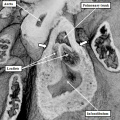 fig 42b Mouse arterial roots and outflow tract