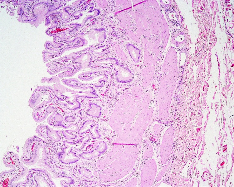File:Gall bladder histology 003.jpg