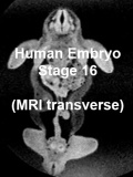 Stage16 MRI T01 icon.jpg
