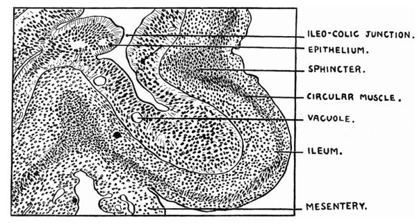 ileo-colic junction in a 32 mm human embryo