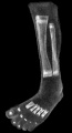 Fig 6 Embryo No. 300 Leg