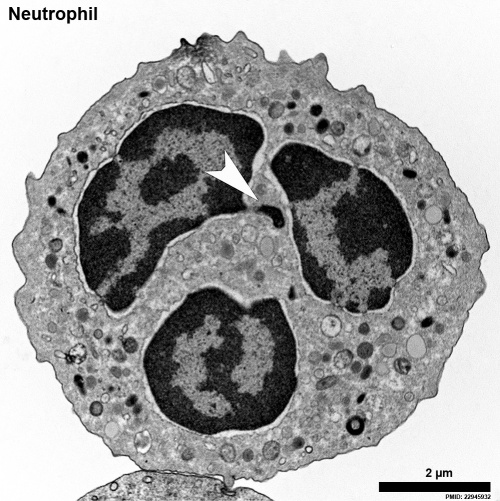 Neutrophil EM01.jpg