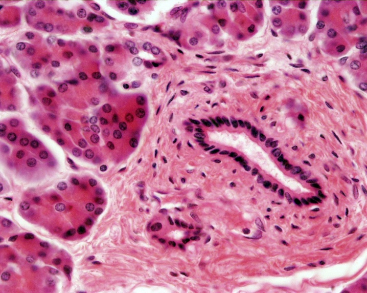 File:Pancreas histology 106.jpg