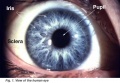 Z3370664 Illustration of the front of the eye, showing the iris, sclera and pupil. Credits: Webvision PMID 21413389