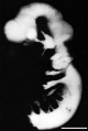 Fig 11 Lateral view of embryo central nervous system at 5 weeks - UNSW image