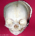 :Skull anterior (anterior fontenelle, sutures, mandible)