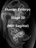Stage20 MRI S02 icon.jpg